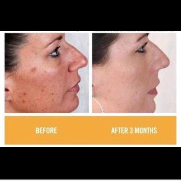 Rodan + Fields Reverse Regimen Steps 2 & 3 - Picture 5 of 6